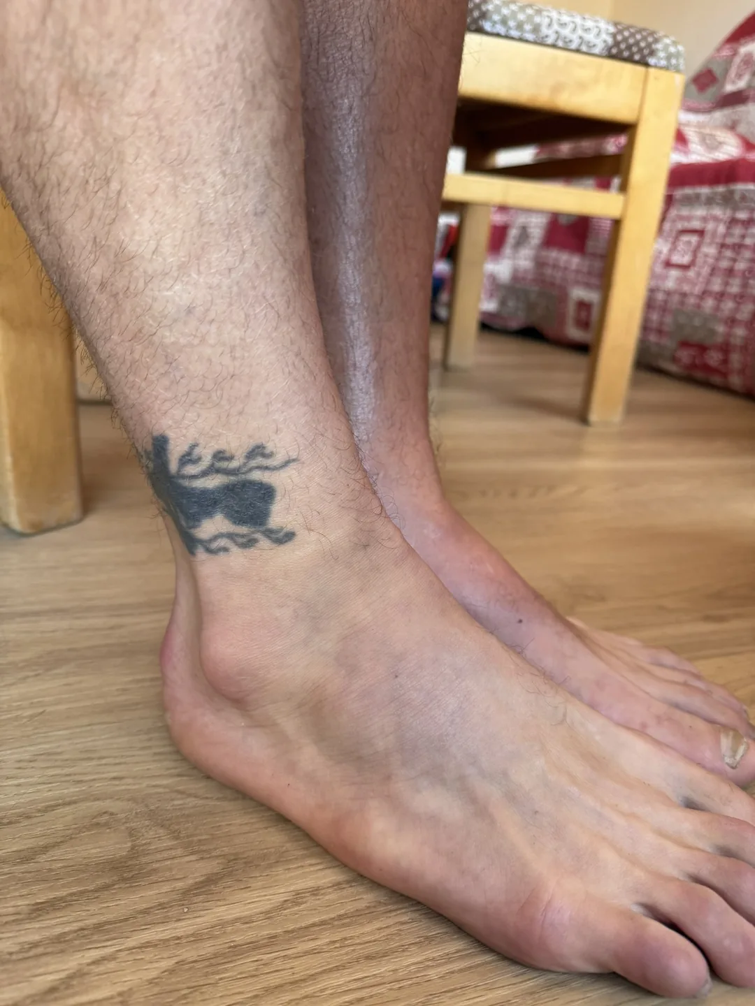 A swollen, bruised left ankle resting on a wooden floor.